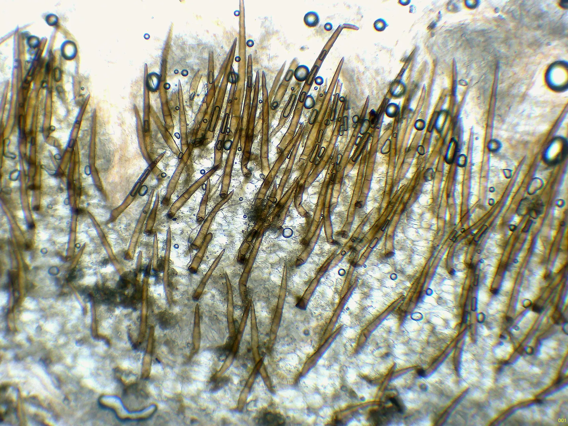 Microscopía de Scutellinia nigrohirtula - 11 - Pelos x 100-001